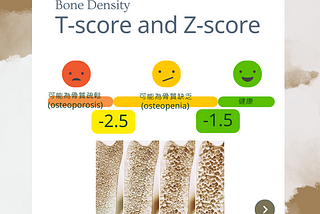 Osteoporosis骨質疏鬆