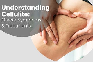 Understanding Cellulite: Effects, Symptoms & Treatments