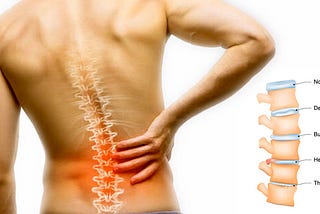 PLDD-Let your intervertebral disc no longer “protrude”