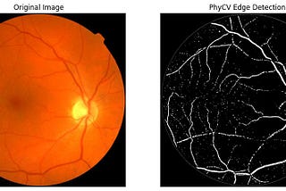 PhyCV - The First Physics inspired Computer Vision Python library