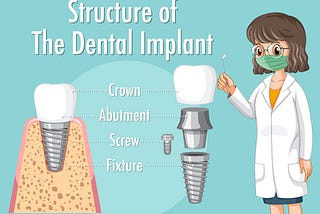 Key Steps in the Dental Implants Procedure