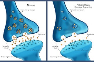 Treatment options for Parkinson’s disease through advancements in technology