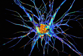 Scommessa decennale sulla coscienza si conclude — e il punteggio è filosofo 1, neuroscienziato 0.