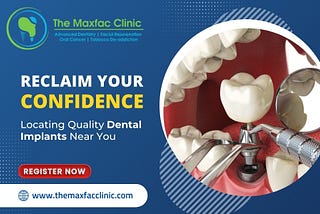 Find Quality Dental Implants Near You to Reclaim Your Confidence