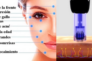 All about the Dermapen mesotherapy!