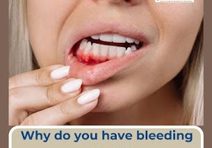 Why do you have bleeding gums? | Prescott Dental Arts | Prescott AZ