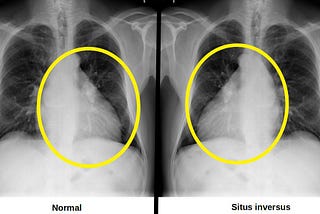 Data Augmentation in Medical Images