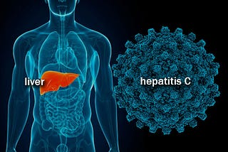 Hepatitis C — A Brief Overview