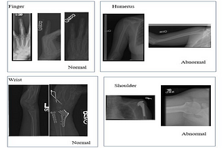 1. Challenges in classifying Body Part X-ray images