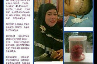 0821 3568 2416 (Bking Nutrisi Otak untuk tumor)