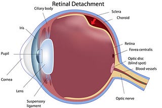Dr. Rohit Varma an expert Ophthalmologist