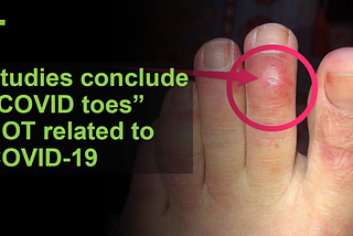 Studies conclude “COVID toes” are not related to COVID-19