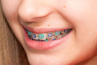 Orthodontic Treatment Address a Wide Range of Orthodontic Issues