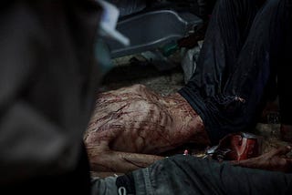 They are slaughtered hungry, thin, and emaciated, their stomachs sticking to their backs from…