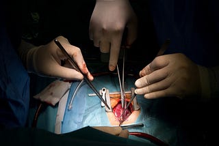 They Cut My Body Seven Layers Deep, Stitched Me Back in Just 30 Minutes