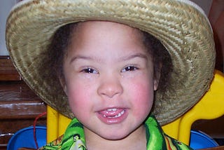 A face shot of a cute little girl who has Down syndrome