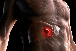 Liver Cancer and Liver Cirrhosis, a Dual Threat