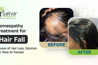 Homeopathy Treatment for Hair Fall — From Root to Tips