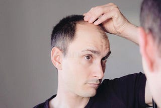 Hair loss, Hair loss in male, Hair loss in men