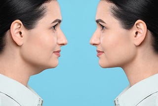 How to Lose Double Chin in 5 Days: Effective Tips and Exercises