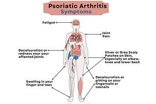 Symptoms of Psoriatic Arthritis