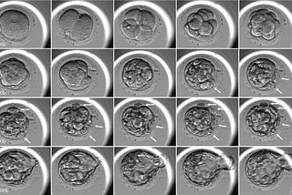 Computer vision for in-vitro fertilization (IVF)