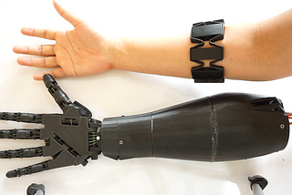 Global Myo-Electric Hand Prosthesis Market 2019 Production, Revenue, Price and Gross Margin…