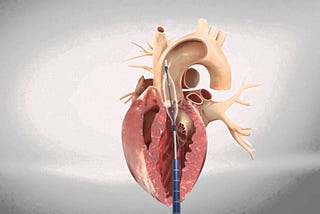 Aortic Stenosis Market