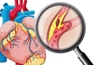 What’s Really Behind Clogged Arteries — Is Eating Cholesterol Really the Problem?