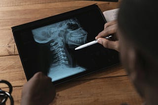 A person examines a digital X-ray image of a cervical spine displayed on a tablet, using a pen to point at a specific vertebra — illustrating medical analysis or patient consultation in a clinical or educational setting. Reflecting the perspective of Ramneek Bhogal on the role of upper cervical chiropractic in nervous system regulation.