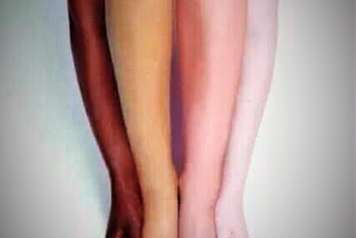A body composed of different skin colors