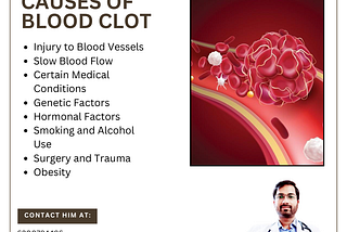 Causes of Blood Clots: Understanding the Risk Factors
