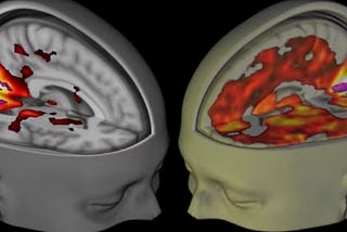 Psychedelics and Psychiatry: Why Psychiatrists Need to Stay Informed