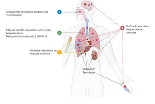 Visão geral da COVID-19 severa: Um modelo de dois “socos” levando a um loop de inflamação…