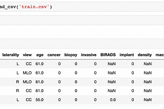 Augment Breast Cancer Diagnosis with Image Classification and LLMs