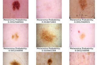 Methods for training a pretrained multimodal image classification model to detect skin malignancies