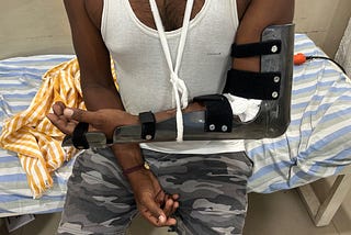 MITHRIL Splints in Orthopaedic Care: Clinical Applications and Outcomes at M J Naidu Hospital