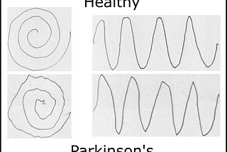 Classifying Parkinson’s disease through image analysis: Part 2