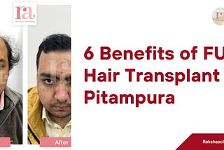 6 Benefits of FUE Hair Transplant in Pitampura