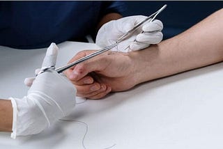 A Guide to the Different Types of Stitches for Wounds