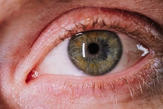Close-up photo of an eye with a reflection on the cornea