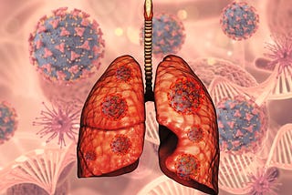 What is lung cancer?