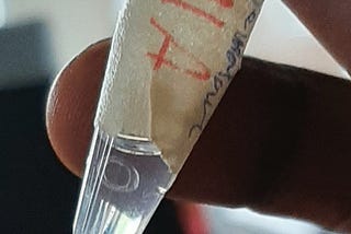 Homemade DNA extraction
