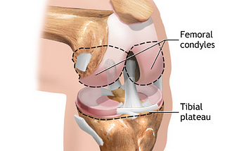 Things you must check prior to your Total Knee Replacement procedure.