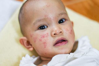Pediatric Dermatology: Common Skin Issues in Children and Treatment Options
