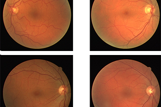 MI-GAN — Generative Adversarial Network for Medical Images