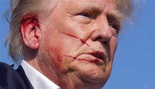 Recent Incident: Shadows of Violence Loom Over Trump’s Campaign