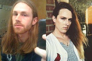 Why I Chose to Be Trans