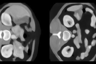 Tutorial: Abdominal CT Image Synthesis with Variational Autoencoders using PyTorch