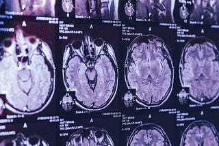 Doctors in Canada are perplexed by a mystery brain disease